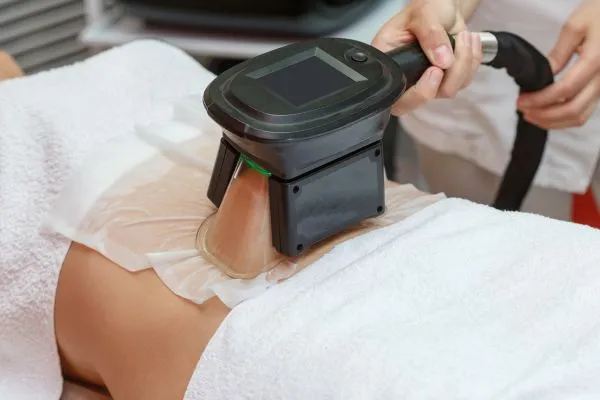 Image of person having fat freezing treatment to help weight gain Oxfordshire