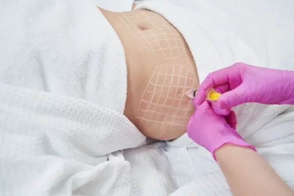 image of fat dissolving injections on love handles to help combat weight gain Oxfordshire