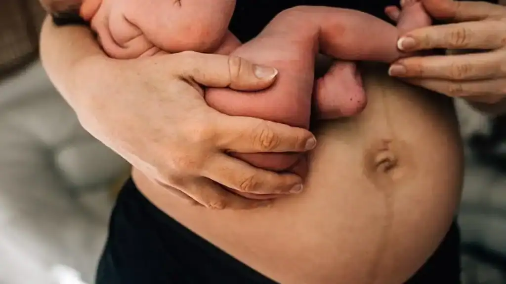 Why Is My Stomach Still Big After Pregnancy Oxfordshire?