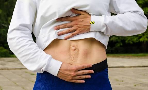 When Could Diastasis Recti Be the Missing Piece of the Puzzle Oxfordshire?
